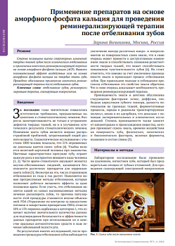 Применение препаратов на основе аморфного фосфата кальция для проведения реминерализирующей терапии после отбеливания зубов
