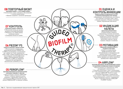 Профилактика воспалительных осложнений при дентальной имплантации у пациентов с воспалительными заболеваниями пародонта в анамнезе